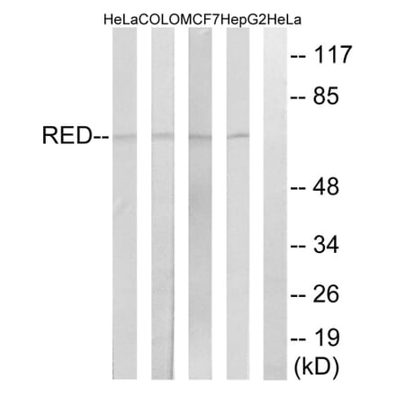 Western Blot - Anti-RED Antibody (C18037) - Antibodies.com