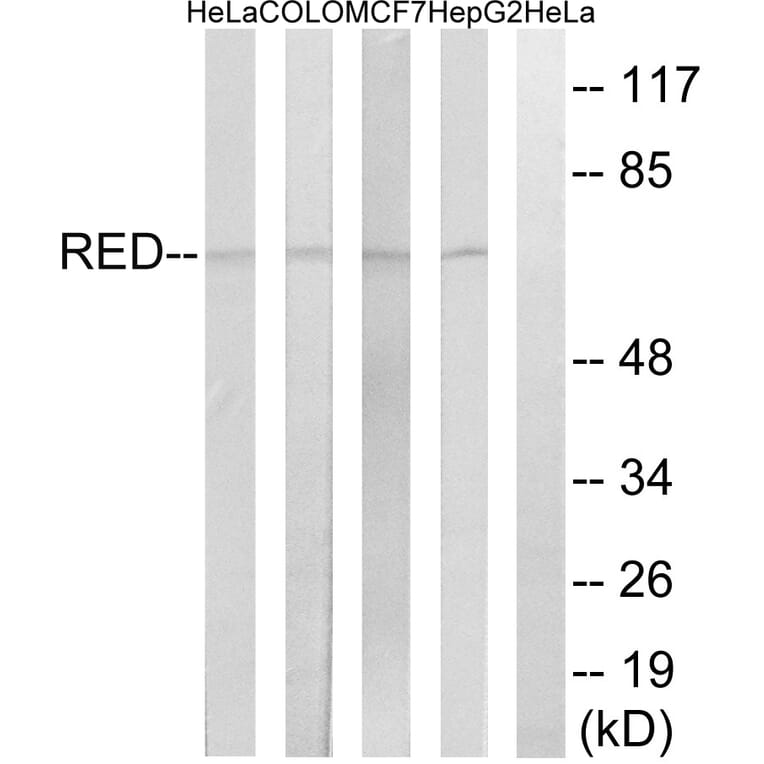 Western Blot - Anti-RED Antibody (C18037) - Antibodies.com