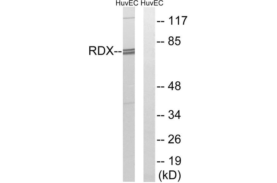 Western Blot - Anti-RDX Antibody (C18143) - Antibodies.com