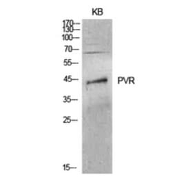 Western Blot - Anti-PVR Antibody (C30513) - Antibodies.com