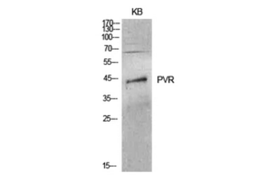 Western Blot - Anti-PVR Antibody (C30513) - Antibodies.com