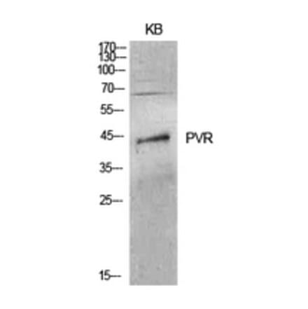 Western Blot - Anti-PVR Antibody (C30513) - Antibodies.com