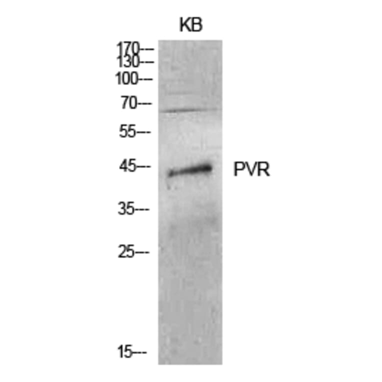 Western Blot - Anti-PVR Antibody (C30513) - Antibodies.com