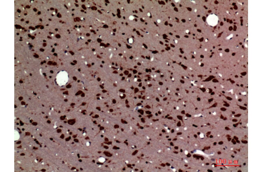 Immunohistochemistry - Anti-PTN Antibody (C30175) - Antibodies.com