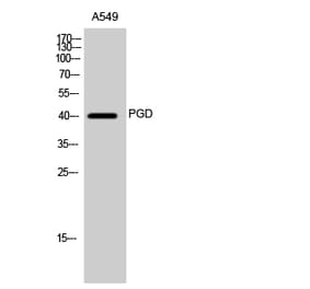 Western Blot - Anti-PGD Antibody (C14199) - Antibodies.com