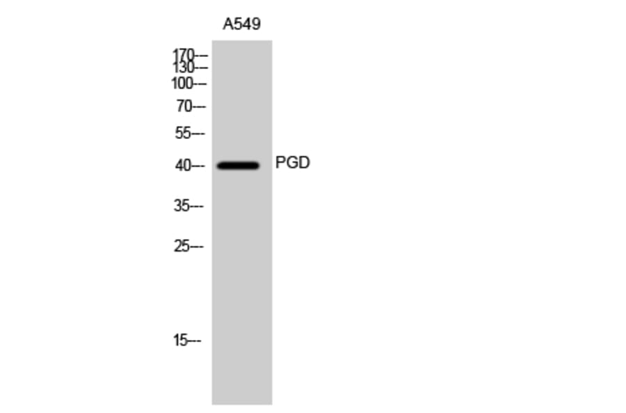 Western Blot - Anti-PGD Antibody (C14199) - Antibodies.com