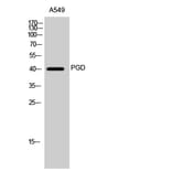 Western Blot - Anti-PGD Antibody (C14199) - Antibodies.com
