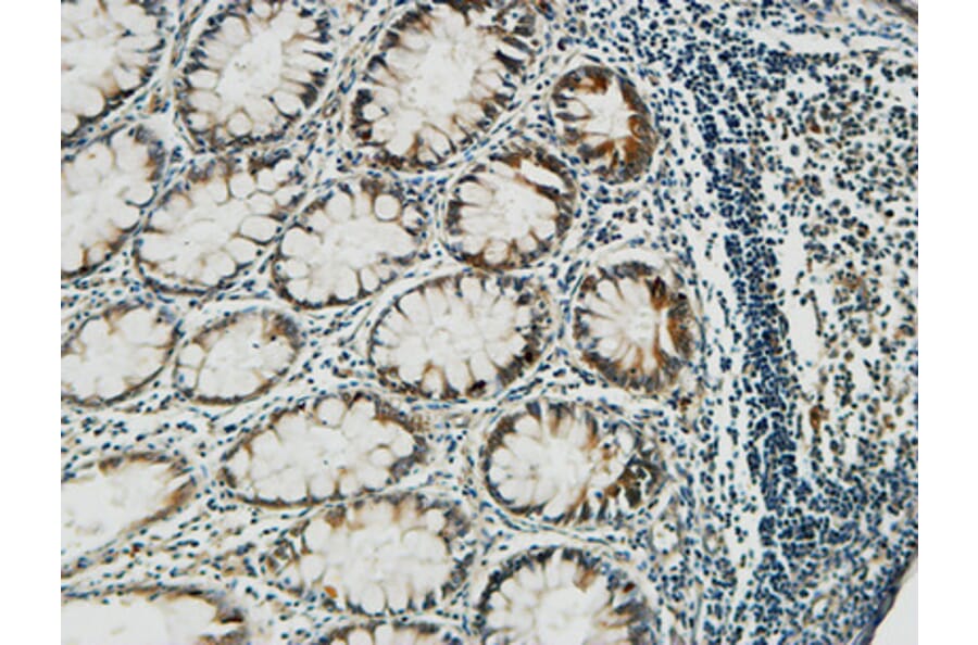 Immunohistochemistry - Anti-PGD Antibody (C14199) - Antibodies.com