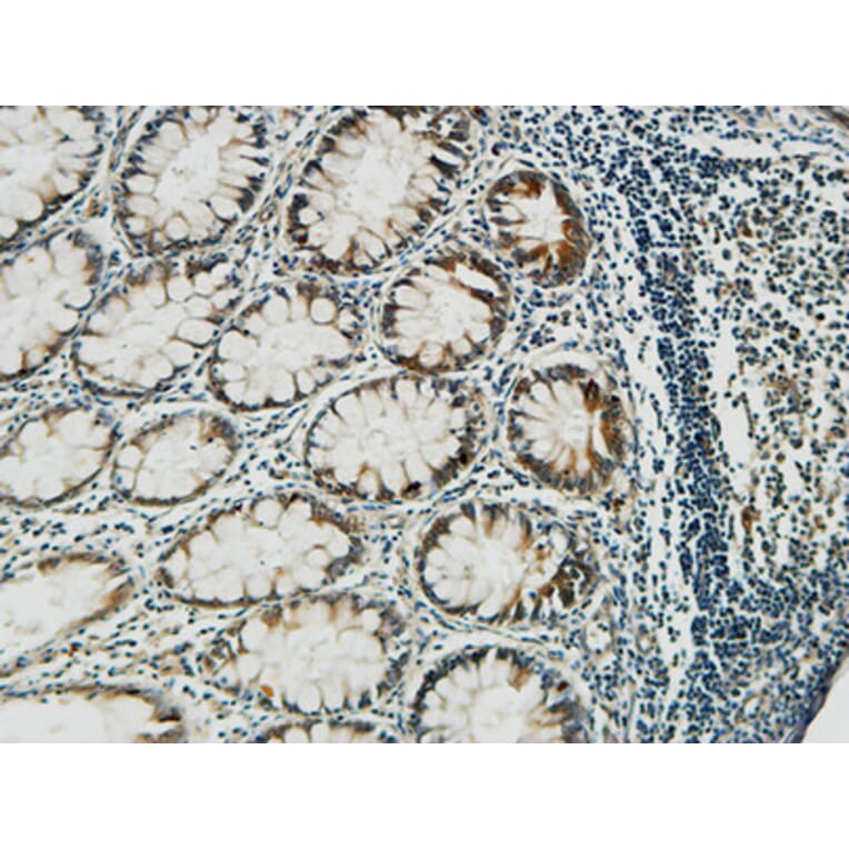 Immunohistochemistry - Anti-PGD Antibody (C14199) - Antibodies.com