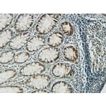 Immunohistochemistry - Anti-PGD Antibody (C14199) - Antibodies.com