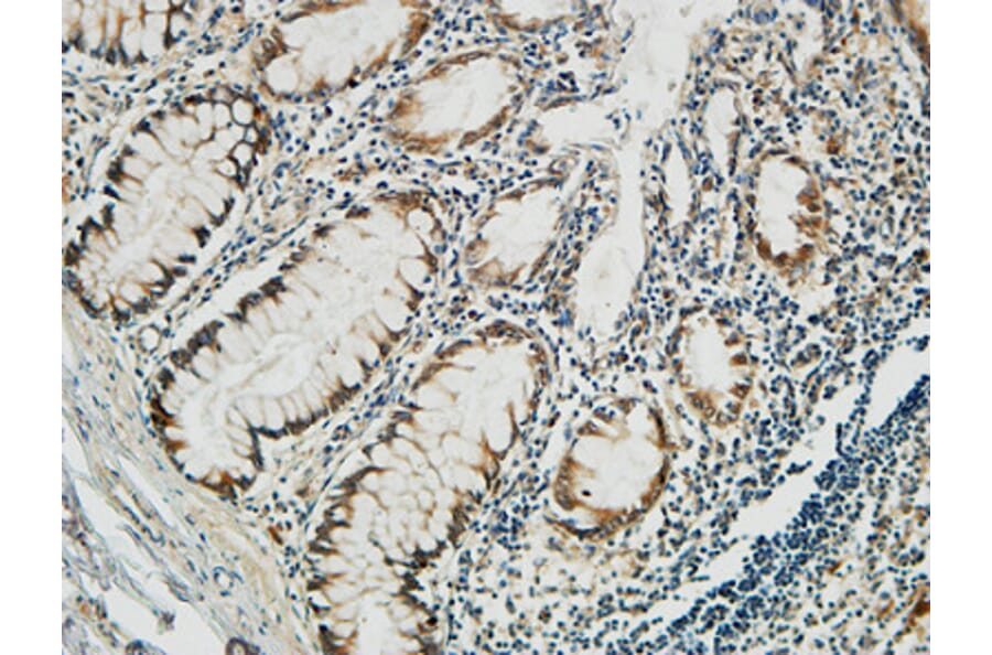 Immunohistochemistry - Anti-PGD Antibody (C14199) - Antibodies.com
