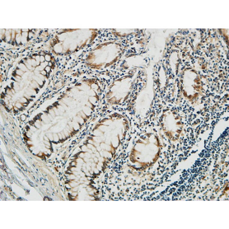 Immunohistochemistry - Anti-PGD Antibody (C14199) - Antibodies.com