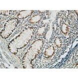 Immunohistochemistry - Anti-PGD Antibody (C14199) - Antibodies.com
