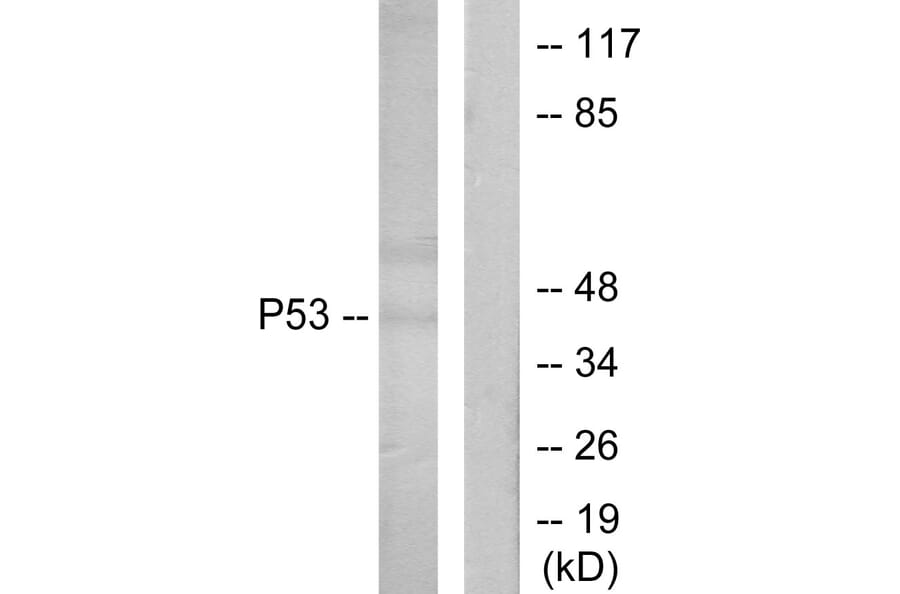 Western Blot - Anti-p53 Antibody (B7187) - Antibodies.com