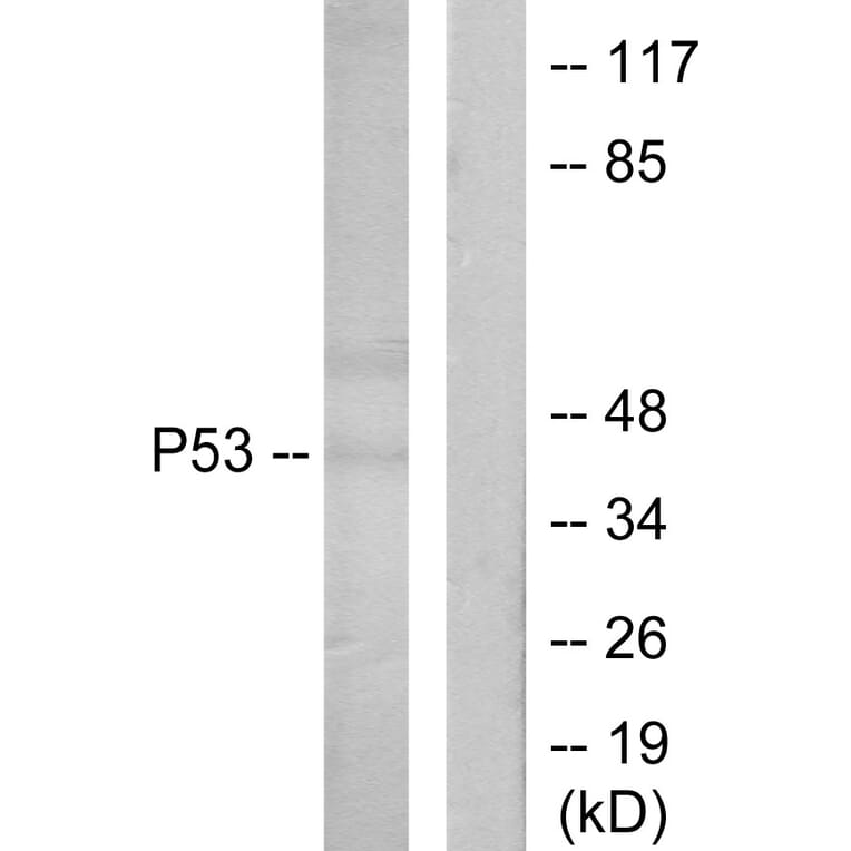 Western Blot - Anti-p53 Antibody (B7187) - Antibodies.com