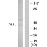 Western Blot - Anti-p53 Antibody (B7187) - Antibodies.com
