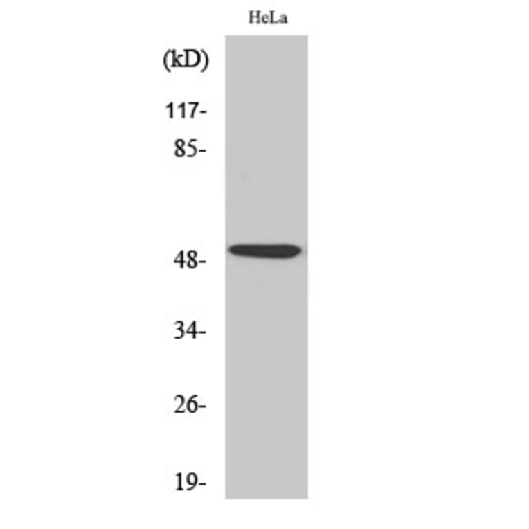 Western Blot - Anti-p53 Antibody (B7187) - Antibodies.com