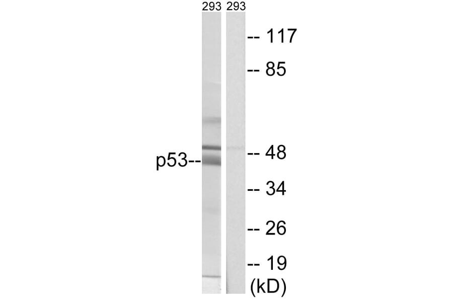 Western Blot - Anti-p53 Antibody (B8054) - Antibodies.com