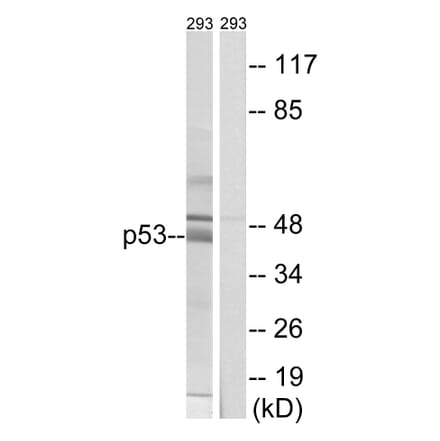 Western Blot - Anti-p53 Antibody (B8054) - Antibodies.com