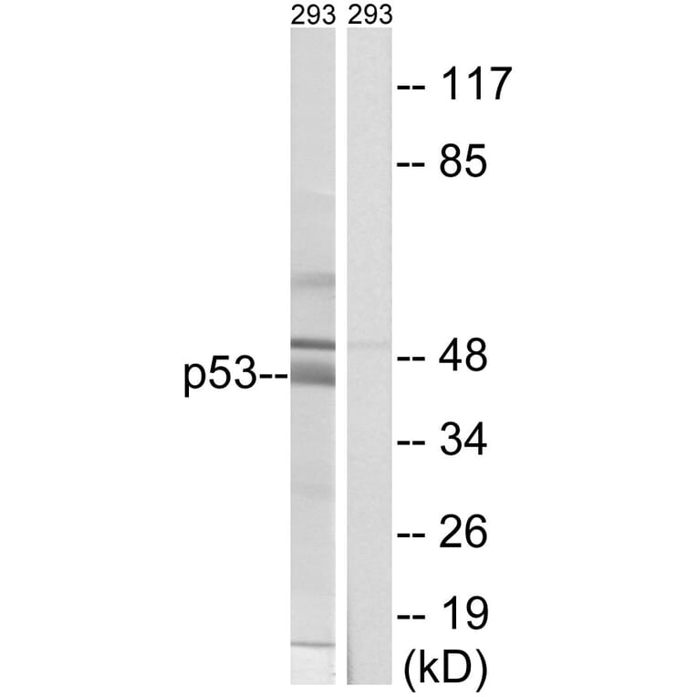 Western Blot - Anti-p53 Antibody (B8054) - Antibodies.com