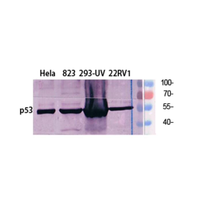Western Blot - Anti-p53 Antibody (B8054) - Antibodies.com