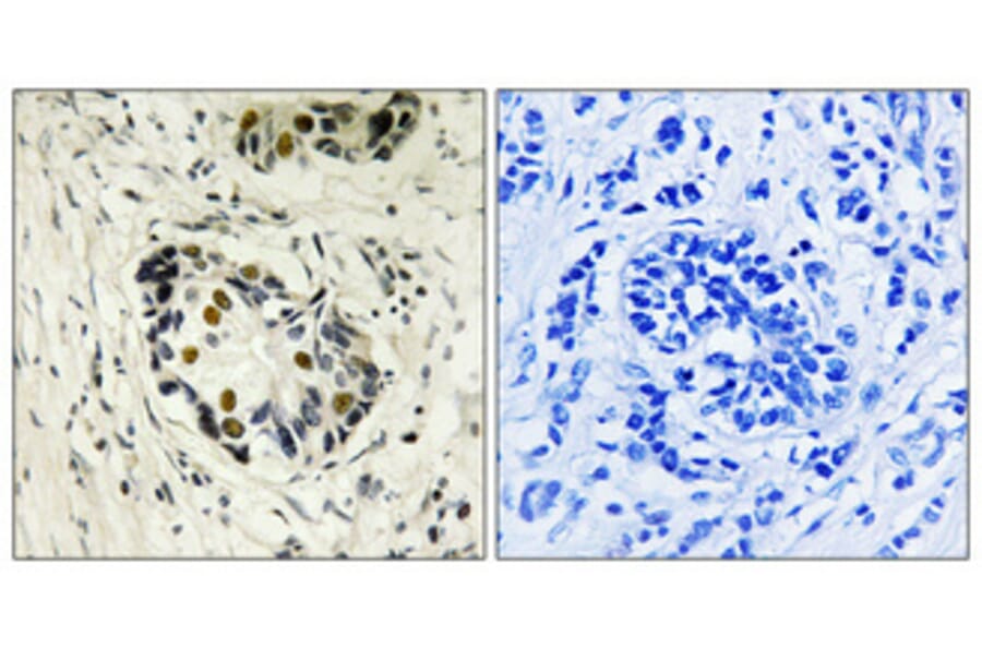 Immunohistochemistry - Anti-p53 Antibody (B8054) - Antibodies.com