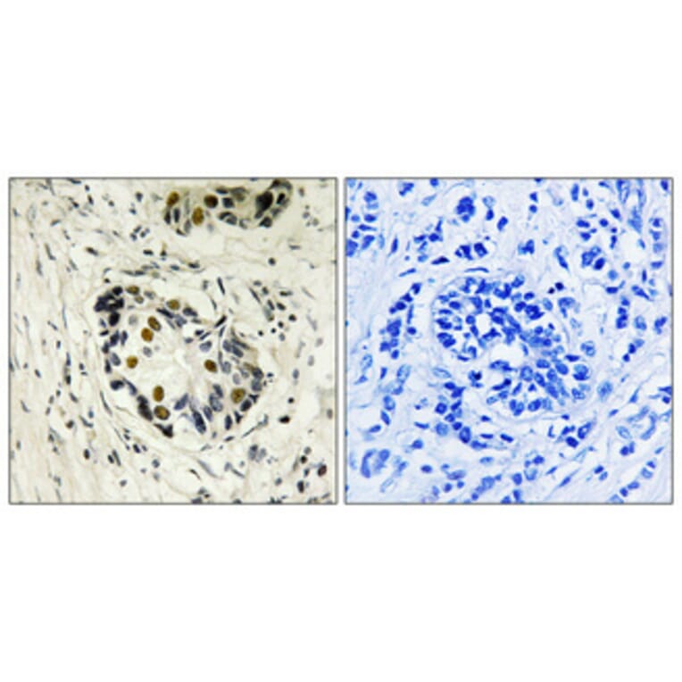 Immunohistochemistry - Anti-p53 Antibody (B8054) - Antibodies.com