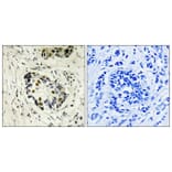 Immunohistochemistry - Anti-p53 Antibody (B8054) - Antibodies.com