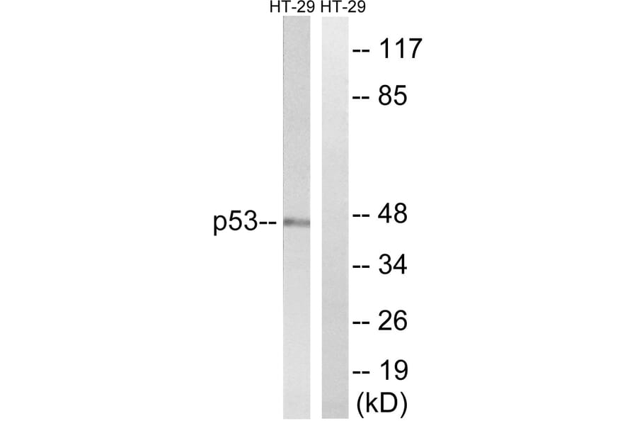 Western Blot - Anti-p53 Antibody (B8052) - Antibodies.com