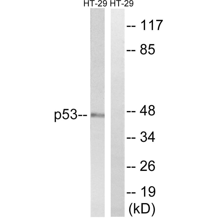 Western Blot - Anti-p53 Antibody (B8052) - Antibodies.com