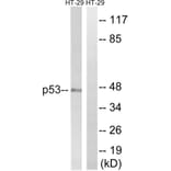 Western Blot - Anti-p53 Antibody (B8052) - Antibodies.com