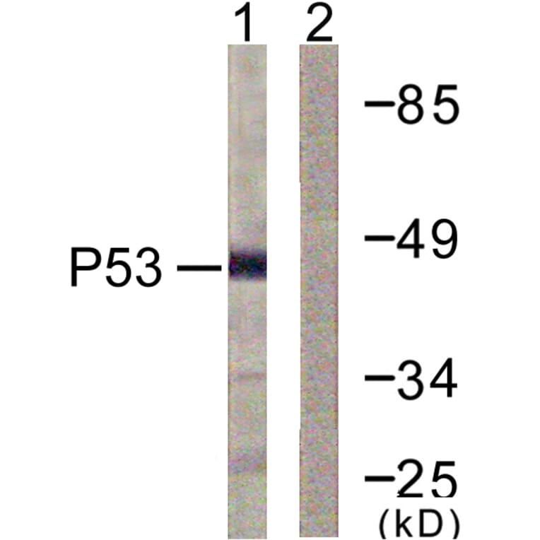 Western Blot - Anti-p53 Antibody (D0036) - Antibodies.com