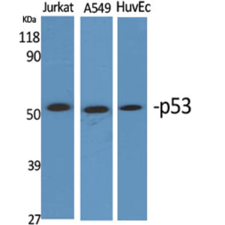 Western Blot - Anti-p53 Antibody (D0036) - Antibodies.com