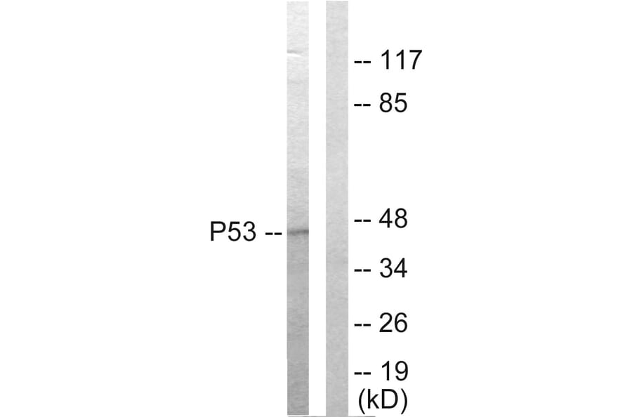 Western Blot - Anti-p53 Antibody (C10276) - Antibodies.com