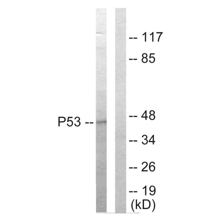 Western Blot - Anti-p53 Antibody (C10276) - Antibodies.com