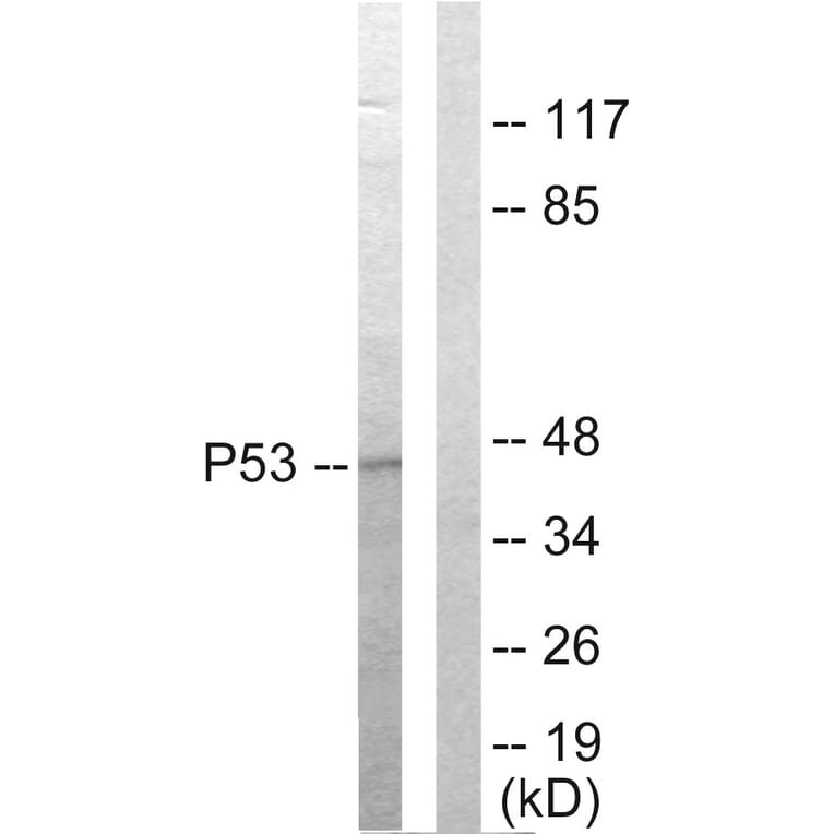 Western Blot - Anti-p53 Antibody (C10276) - Antibodies.com