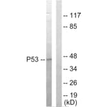Western Blot - Anti-p53 Antibody (C10276) - Antibodies.com