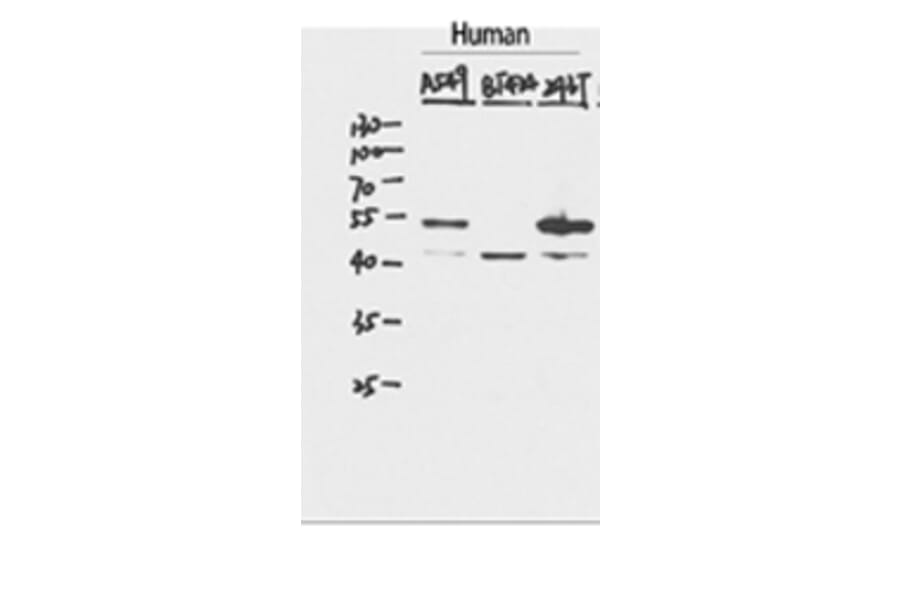 Western Blot - Anti-p53 Antibody (C10276) - Antibodies.com