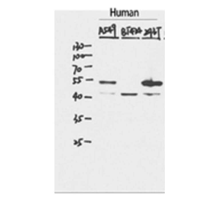 Western Blot - Anti-p53 Antibody (C10276) - Antibodies.com