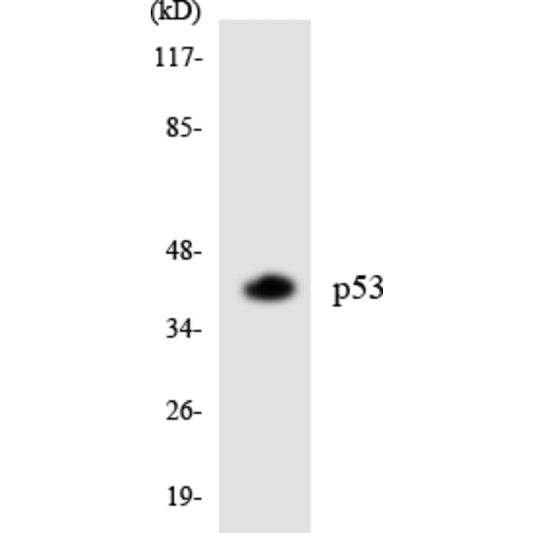 Western Blot - Anti-p53 Antibody (R12-3288) - Antibodies.com