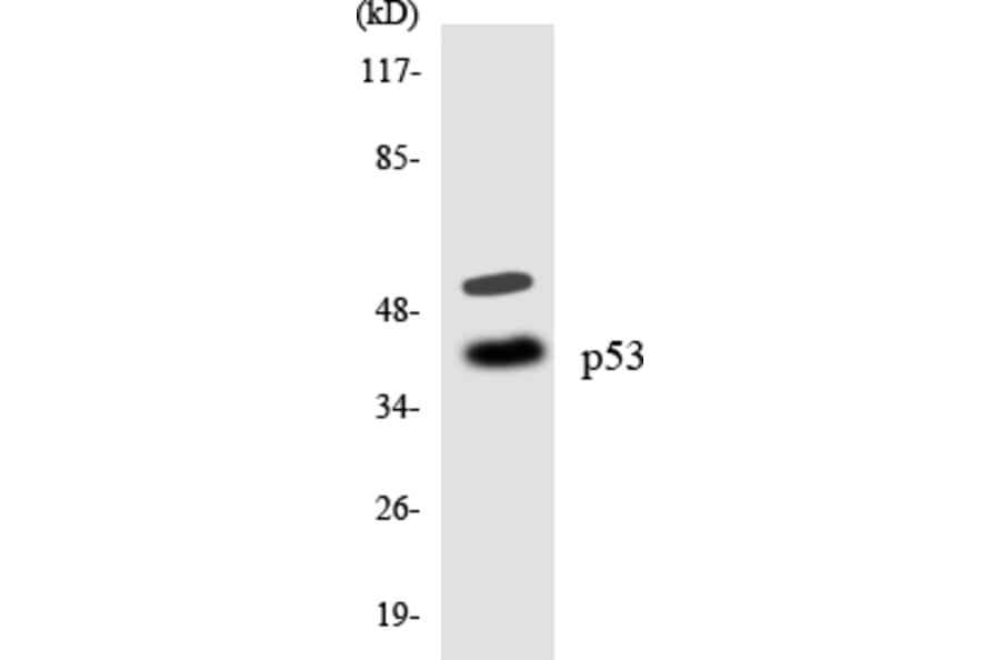 Western Blot - Anti-p53 Antibody (R12-3289) - Antibodies.com
