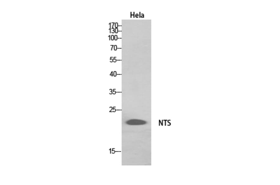 Western Blot - Anti-NTS Antibody (C30991) - Antibodies.com