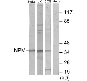 Western Blot - Anti-NPM Antibody (C11642) - Antibodies.com