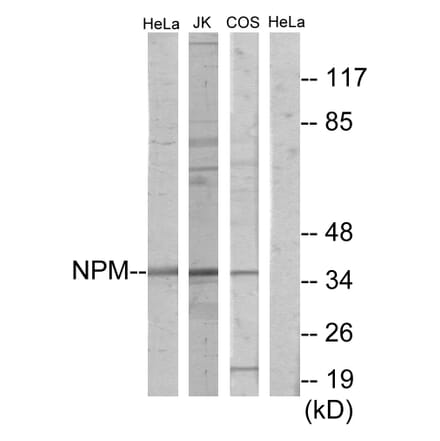 Western Blot - Anti-NPM Antibody (C11642) - Antibodies.com