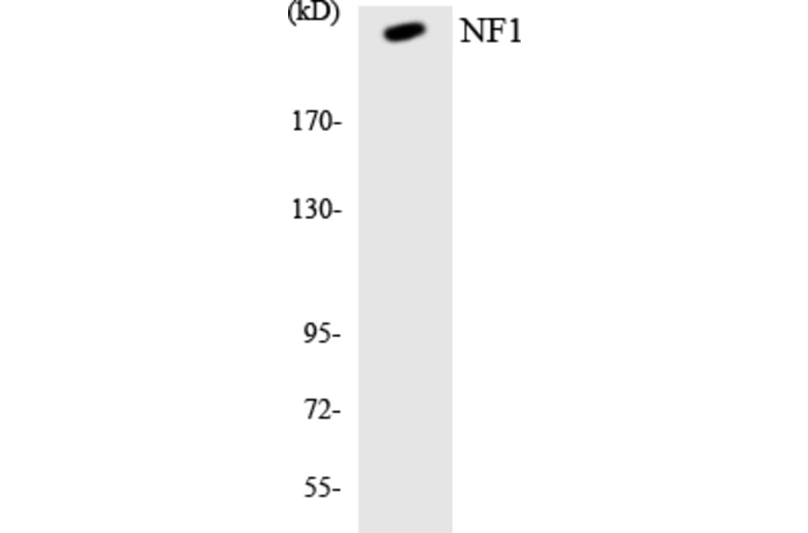 Western Blot - Anti-NF1 Antibody (R12-3089) - Antibodies.com
