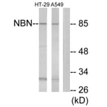 Western Blot - Anti-NBN Antibody (C13093) - Antibodies.com