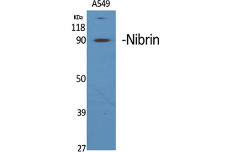 Western Blot - Anti-NBN Antibody (C13093) - Antibodies.com