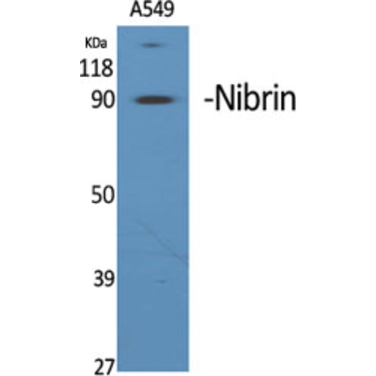 Western Blot - Anti-NBN Antibody (C13093) - Antibodies.com