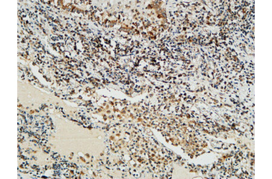 Immunohistochemistry - Anti-NBN Antibody (C13093) - Antibodies.com
