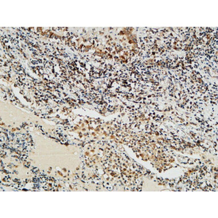 Immunohistochemistry - Anti-NBN Antibody (C13093) - Antibodies.com
